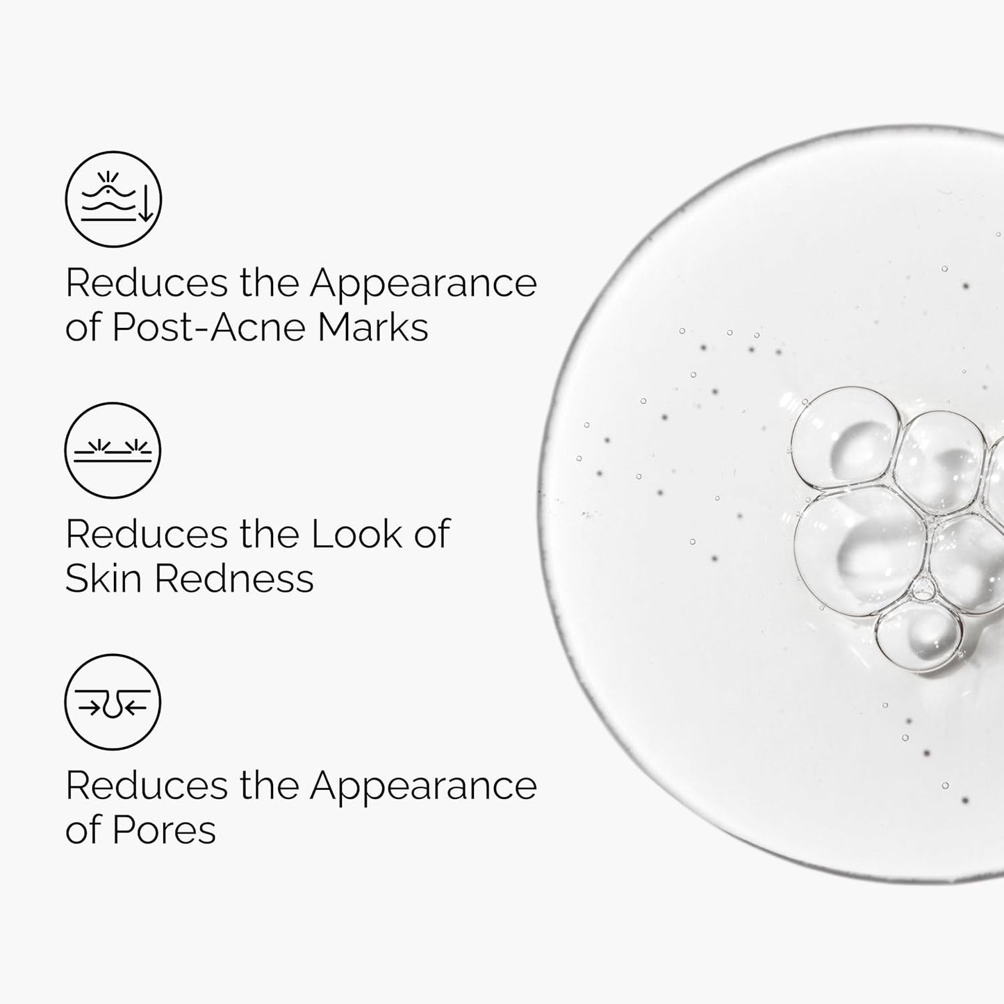 The Ordinary Aloe 2% + NAG 2% Solution, Soothes Skin and Targets Post-Acne Marks, 1 Fl Oz